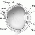 eye disease