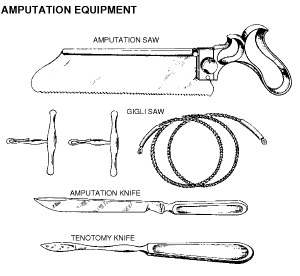 amputations